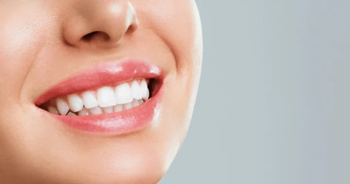 マウスピース矯正中のホワイトニングと歯の色のイメージ